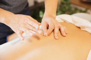 acupuncture treatment applying needles on back