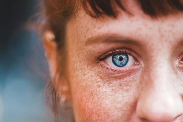 Woman with blue eyes and freckles